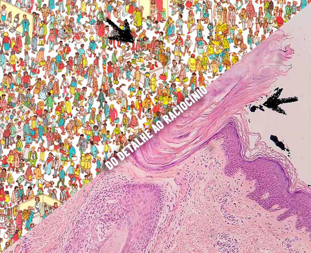BPP-onde-esta-wally-lamina-dermatoscopia-DO-DETALHE-AO-RACIOCINIO